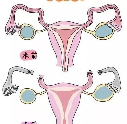 北京试管婴儿费用详解，医保报销多少？
